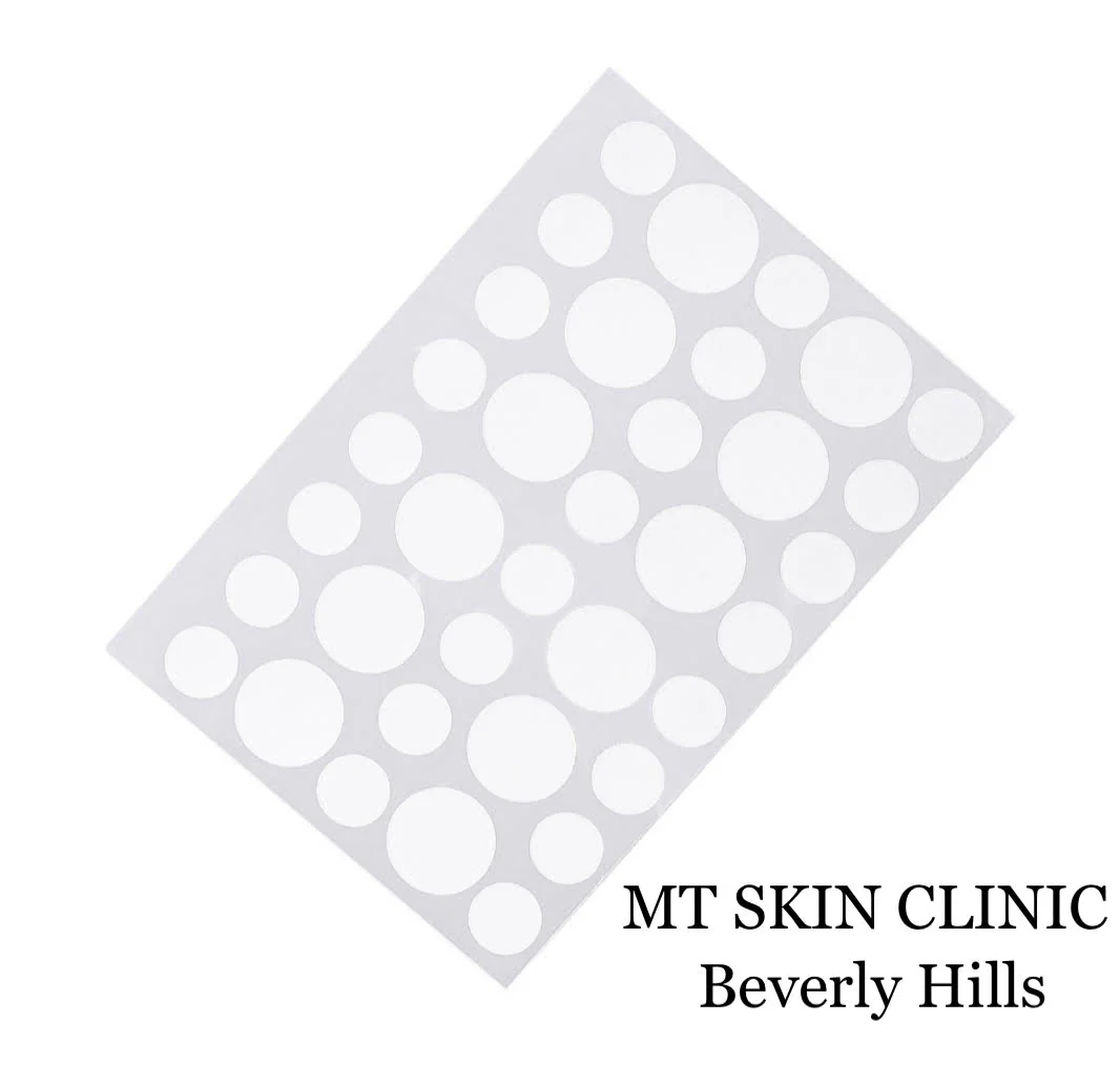 Acne Pimple Patches - Image 2