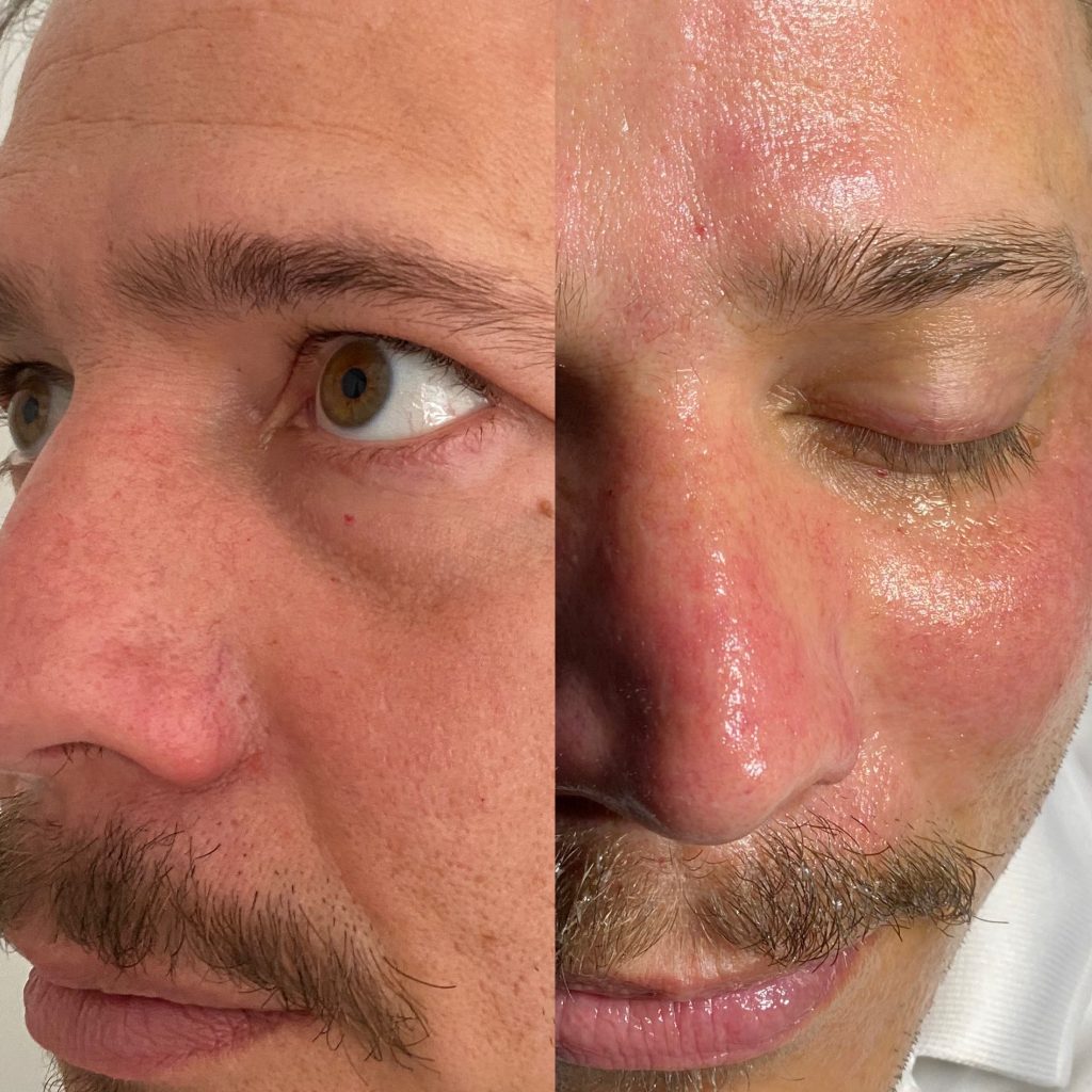 Billion-Dollar Facial Experience